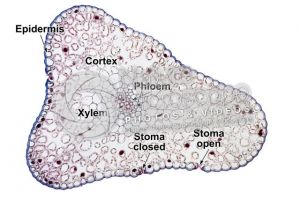 Psilotum nudum. Whisk fern. Stem. Protostele. Transverse section. 125X