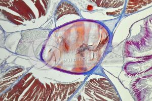 Branchiostoma. Lancet. Spinal cord and notochord. Transverse section. 100X