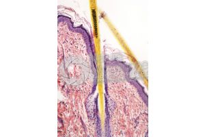Man. Scalp. Vertical section. 100X