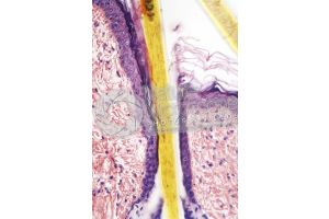 Man. Scalp. Vertical section. 200X