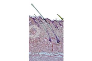 Man. Scalp. Vertical section. 32X