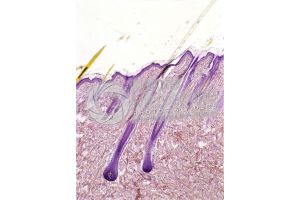 Man. Scalp. Vertical section. 50X