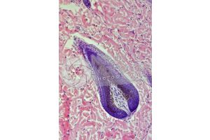 Man. Scalp. Vertical section. 100X