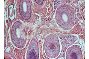 Man. Scalp. Transverse section. 125X