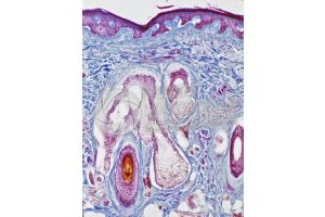 Man. Scalp. Oblique section. 125X
