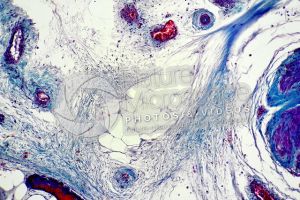 Mammal. Unilocular adipose tissue. Transverse section. 125X