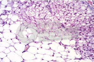 Rat. Multilocular adipose tissue. Transverse section. 125X