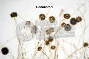 Aspergillus sp. Muffa. Fungo saprofita. Conidioforo. 100X