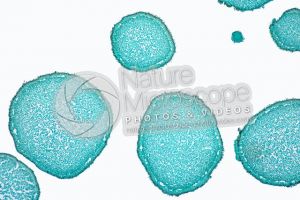 Hydnum sp. Fungus. Spine. Transverse section. 64X
