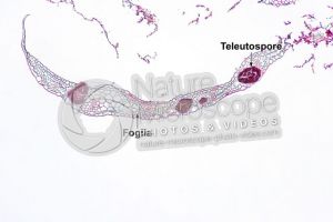 Ustilago tritici. Carbone del frumento. Fungo parassita. Sezione trasversale. 64X