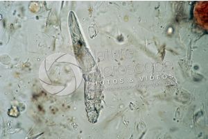 Demodex canis. Demodectic mange. 100X