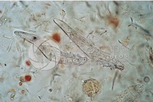 Demodex canis. Demodectic mange. 100X