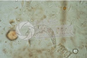 Demodex canis. Demodectic mange. 100X