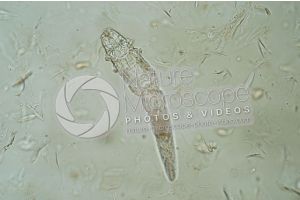 Demodex canis. Demodectic mange. 100X