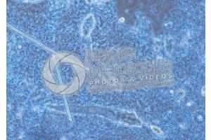 Demodex folliculorum. Demodectic mange. 100X