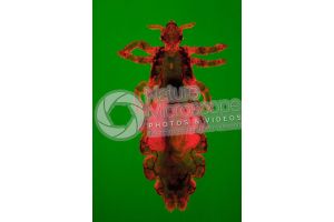 Pediculus humanus capitis. Head louse. Pediculosis. Dorsal view