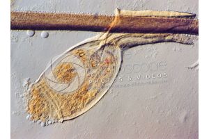Pediculus humanus capitis. Head louse. Nit. Pediculosis. 100X