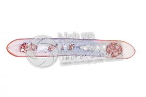 Taenia solium. Tapeworm. Taeniasis. Transverse section. 5X