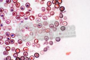 Taenia solium. Tapeworm. Taeniasis. Transverse section. 125X