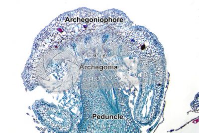 Marchantia polymorpha. Common liverwort. Archegonium in initial stage. Longitudinal section. 64X