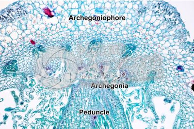 Marchantia polymorpha. Common liverwort. Archegonium in initial stage. Longitudinal section. 125X