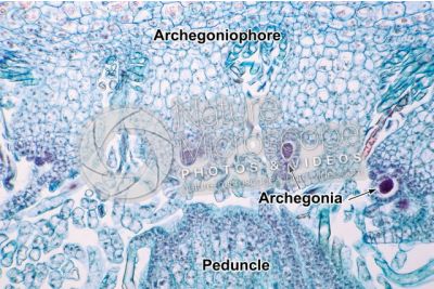 Marchantia polymorpha. Common liverwort. Archegonium in initial stage. Longitudinal section. 250X