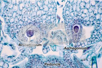 Marchantia polymorpha. Common liverwort. Archegonium in initial stage. Longitudinal section. 500X