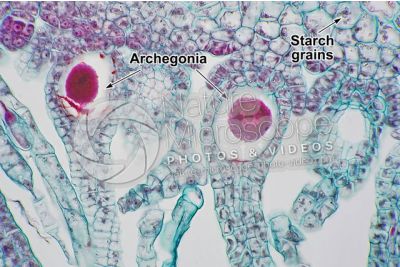 Marchantia polymorpha. Common liverwort. Archegonium in intermediate stage. Longitudinal section. 500X
