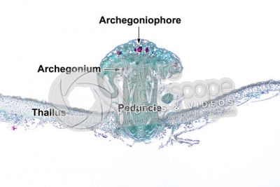 Marchantia polymorpha. Common liverwort. Archegonium in advanced stage. Longitudinal section. 32X