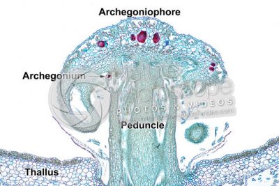 Marchantia polymorpha. Common liverwort. Archegonium in advanced stage. Longitudinal section. 64X
