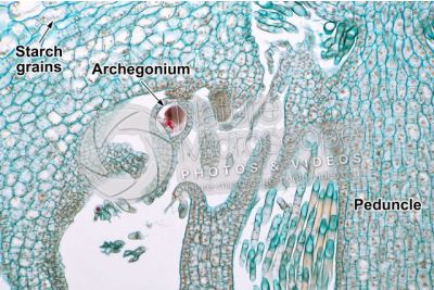 Marchantia polymorpha. Common liverwort. Archegonium in advanced stage. Longitudinal section. 250X