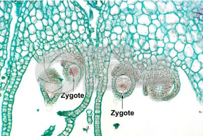 Marchantia polymorpha. Common liverwort. Zygote. Longitudinal section. 250X