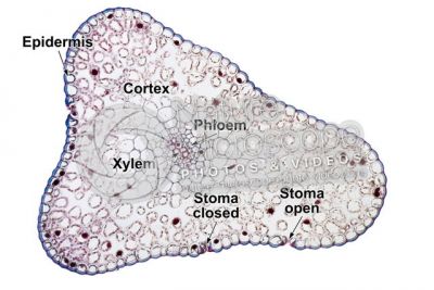 Psilotum nudum. Whisk fern. Stem. Protostele. Transverse section. 125X
