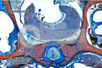 Petromyzon sp. Lamprey. Spinal cord and notochord. Transverse section. 64X