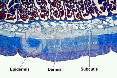 Petromyzon sp. Lamprey. Skin and epidermis. Transverse section. 100X