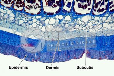 Petromyzon sp. Lamprey. Skin and epidermis. Transverse section. 100X