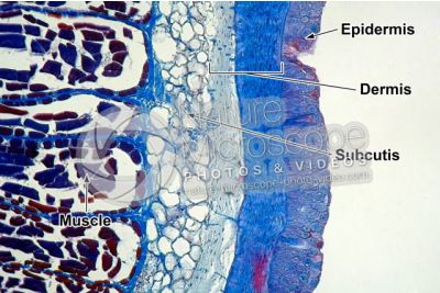 Petromyzon sp. Lamprey. Skin and epidermis. Transverse section. 100X