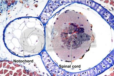 Salamandra salamandra. Salamander. Larva. Spinal cord and notochord. Transverse section. 125X
