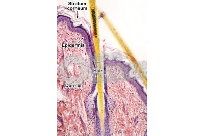 Man. Scalp. Vertical section. 100X