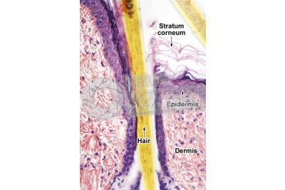 Man. Scalp. Vertical section. 200X