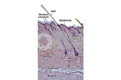 Man. Scalp. Vertical section. 32X