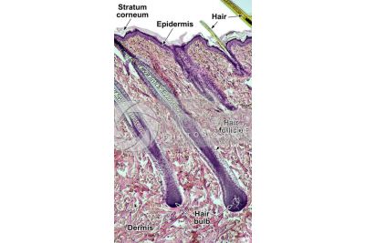 Man. Scalp. Vertical section. 64X