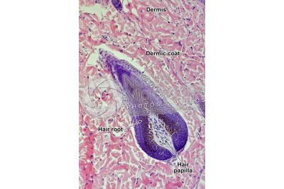 Man. Scalp. Vertical section. 100X