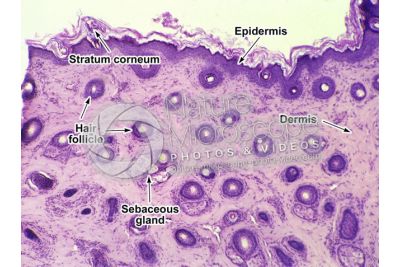 Man. Scalp. Transverse section. 32X