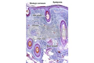 Man. Scalp. Transverse section. 64X