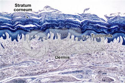 Man. Skin and epidermis. Vertical section. 40X
