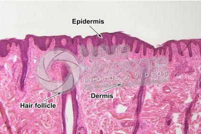 Man. Skin and epidermis. Vertical section. 100X