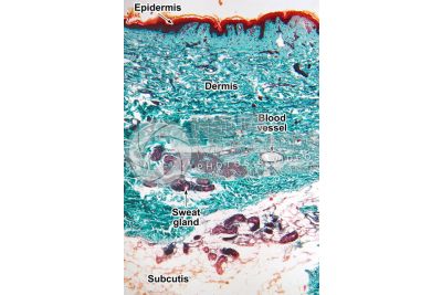 Man. Skin and epidermis. Vertical section. 64X
