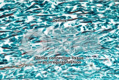 Man. Skin and epidermis. Vertical section. 250X