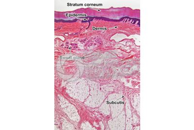 Man. Skin and epidermis. Vertical section. 32X
